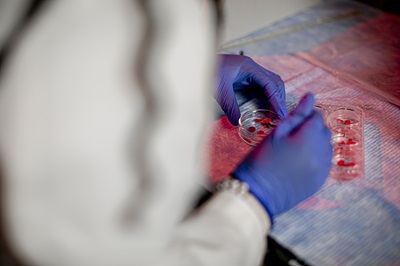 hands with gloves on working with a petri dish