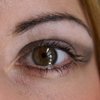 Don't Lose Sight of Glaucoma Risk Factors