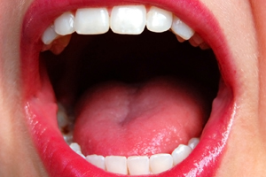 Through better understanding of how the mouth and body work to produce non-stuttered speech, patients are able to improve their speaking abilities over time.